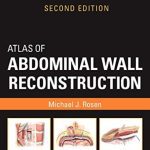 Abdominal Wall Reconstruction By Michael J Rosen MD PDF Free Download