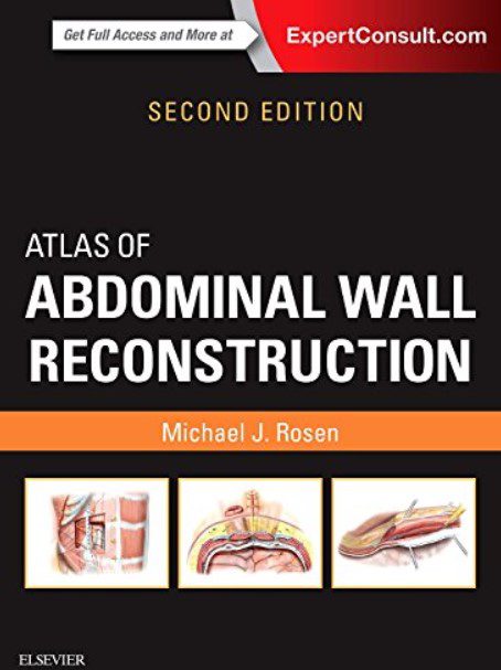 Abdominal Wall Reconstruction By Michael J Rosen MD PDF Free Download