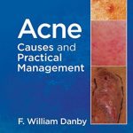 Acne Causes and practical management By F. William Danby PDF Free Download