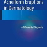 Acneiform Eruptions in Dermatology A Differential Diagnosis PDF Free Download