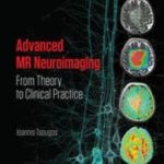 Advanced MR Neuroimaging from Theory to Clinical Practice PDF Free Download