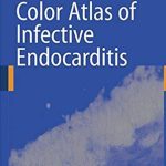 Color Atlas of Infective Endocarditis PDF Free Download