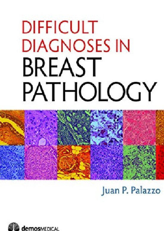 Difficult Diagnoses in Breast Pathology Latest Edition PDF Free Download