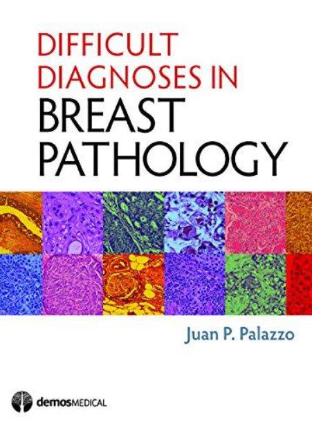 Difficult Diagnoses in Breast Pathology PDF Free Download