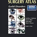 Oculoplastic Surgery Atlas: Eyelid Disorders PDF Free Download