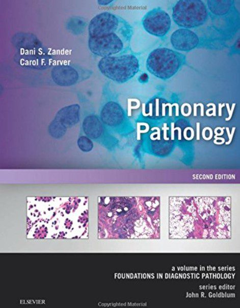 Pulmonary Pathology 2nd Edition PDF Free Download