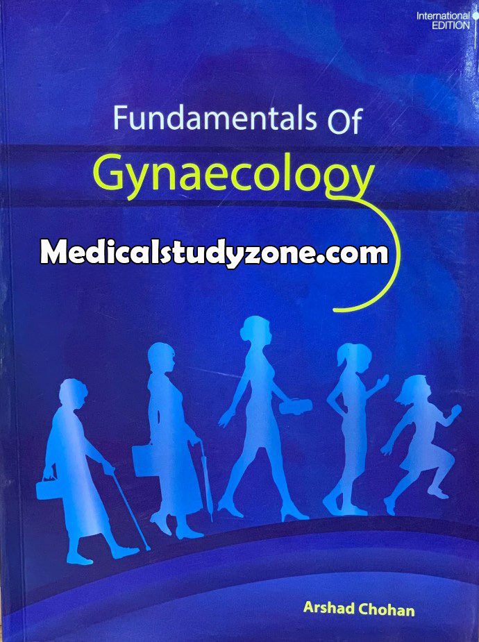 Fundamentals Of Gynaecology by Arshad Chohan PDF Free Download