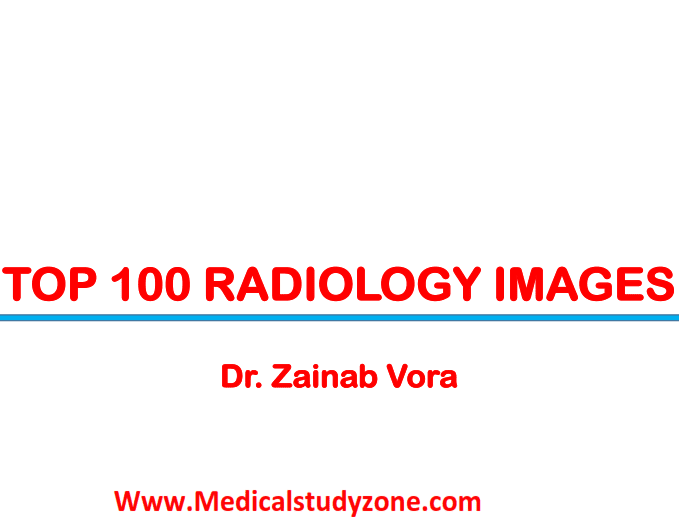 Top 100 Radiology Images By Dr Zainab Vora PDF Free Download cover
