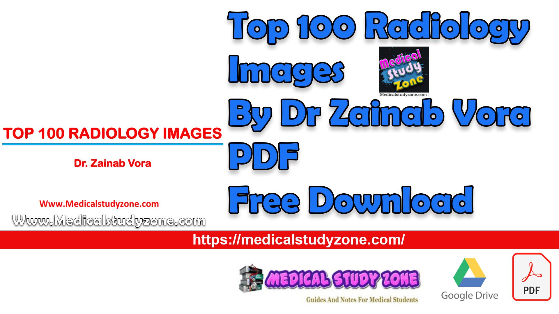 Top 100 Radiology Images By Dr Zainab Vora PDF Free Download