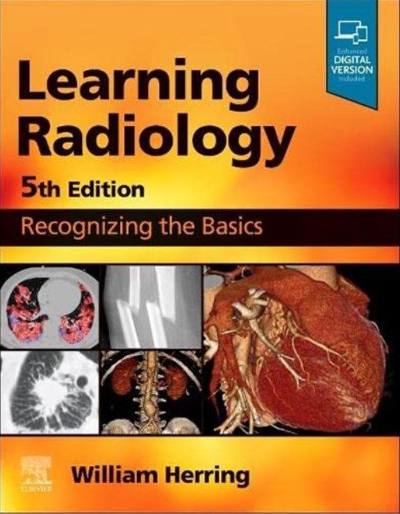 Learning Radiology: Recognizing the Basics 5th Edition PDF Free Download cover
